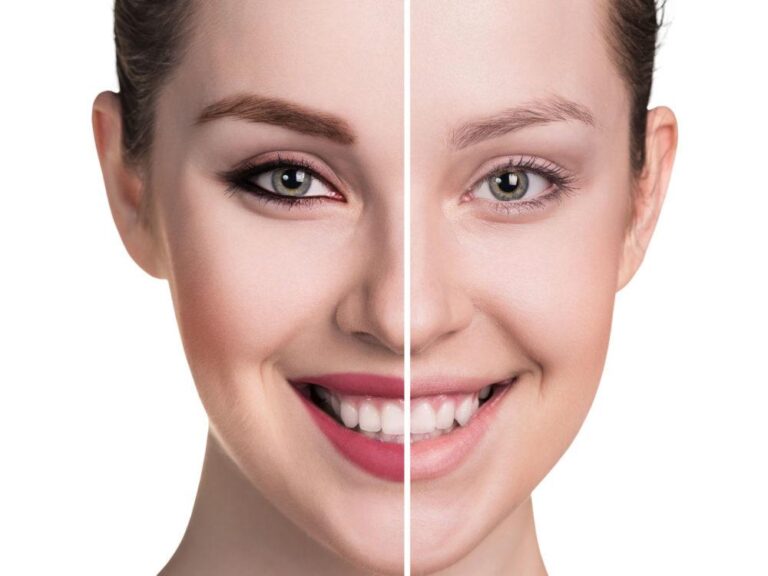 محبوب‌ترین روش‌های آرایش دائمی صورت را بشناسید